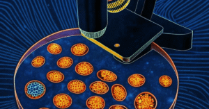 Rare disease market sizing when most patients are undiagnosed. Ulana Rey PharmD MindLumina